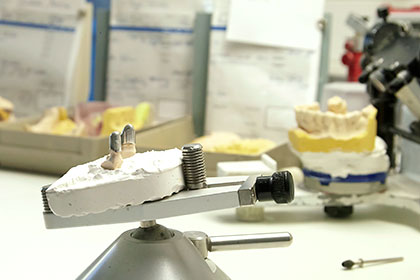 Zahnlabor – Prothese und Instrumente